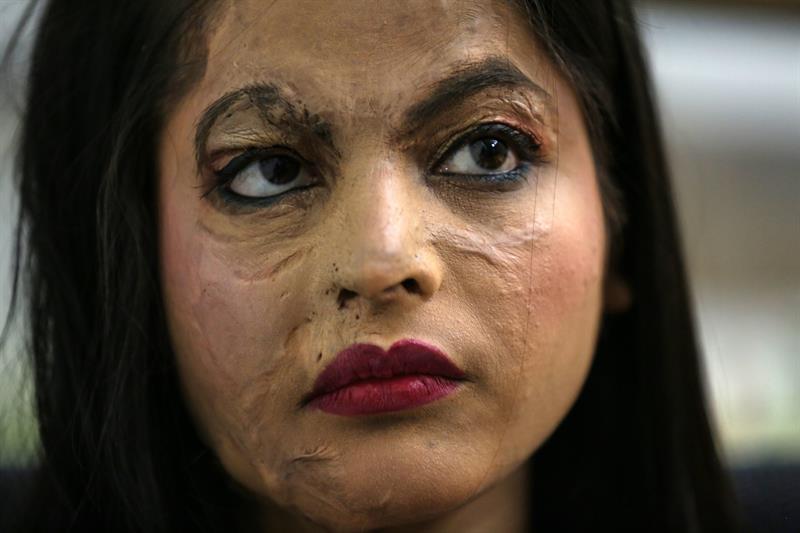 Una superviviente por ataque de ácido desfila durante un evento de moda en Thane, cerca de Bombai, India. El evento es organizado por la Fundación ONG Sobrevivientes por Ácido y bienestar de las mujeres, que protestan contra la venta de ácido y los ataques contra las mujeres. Foto: Divyakant Solanki, EFE